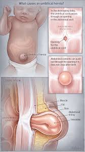 Pin On Patient Information Pages