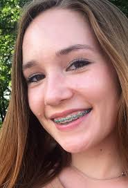 Black And White Braces Color Pin By Kimberly On Mouth Braces Cute Braces Braces Colors Braces Girls