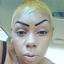 Severe headache, nausea, seizures, confusion, and fainting are all signs of  a ruptured brain aneurysm. It's a medical emergency. Call 911 immediately.