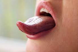 Image result for yellow tongue infection