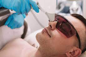 Should you get laser hair removal in your nose? How To Remove Nose Hairs For Good Laser Removal Guide