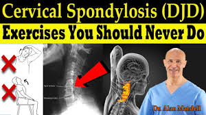 Cervical Spondylosis Djd Exercises You Should Never Do