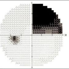 Dots Squiggles And Triangles Oh My A Visual Field Guide