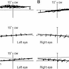 Assessment Of Newborn Reflexes | Ppt