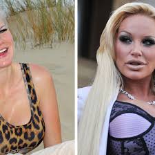 Botox und hyaluronsäure vor promi bb full article. Gina Lisa Lohfink Mein Hund Hat Einen Besseren Charakter Als Du Stern De