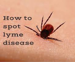 Image result for Tick Bite