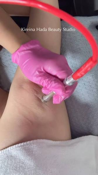 Brightening cream being applied to the hands