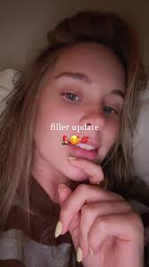 White Claw Lip Peptide Drama