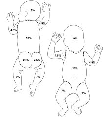 Rule Of Nines Chart Child 2019