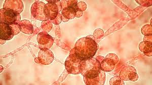 Check spelling or type a new query. White Fungus Drug Resistant Fungal Infections Pose Threat To India Patients Bbc News
