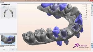 Pin On Digital Dental Lab