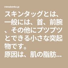 スキンタッグを自然に取り除く６つの方法 みんな健康 健康 ヒンメリ 肌