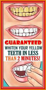 Put Vicks Vaporub On This Place On Your Body Every Night Before Sleeping Here Are The Amazing Effects Yellow Teeth White Teeth Teeth