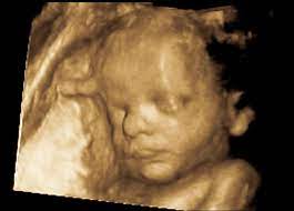 Ssw kann dein babys selbstständig atmen. 34 Schwangerschaftswoche 34 Ssw Alle Infos Eltern De