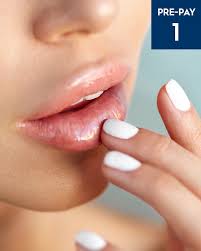 No hair removal method is permanent, although some do last quite a while. Laser Hair Removal Upper Lip Australian Skin Clinics