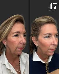 Cameron Bowling, BSN, RN (@injectorcam) • Instagram photos and videos