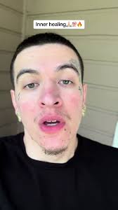 Inner healing🙏🏼💯🔥#deliverance #manofgod #inspirational  #christianitytiktok #jesus #demonslayer #demonslayer #deliverance