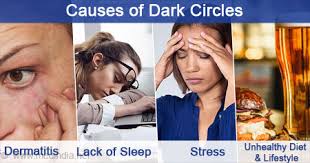 Dark circles cannot be removed within a day it does require time to get through it. How To Get Rid Of Dark Circles Through Facial Exercise