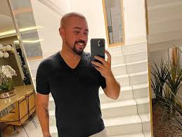 Nosso querido ex bbb @wagnersantiago_ realizou seu sonho , deu adeus a calvície. Xand Aviao Faz Transplante Capilar E Brinca Carequinha Exotico