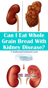 Kidney Disease Diet Ideas Polycystic Kidney Disease Kidney Disease Kidney Disease Symptoms