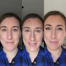 In love with result 🫣🤩❤️Airtouch +Highlight Before and after