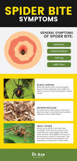 6 Natural Ways To Deal With A Spider Bite If It Really Is A