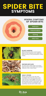 6 natural ways to deal with a spider bite if it really is a