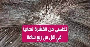 عندما يتعلق الأمر بقشرة الرأس فإنه أمر محبط حقا إلى ما لا نهاية فغالبا بحتث في كل مكان عن العلاجات الطبيعية للتخلص convenience store convenience store products
