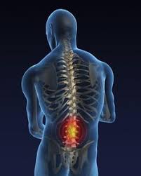 Pin On Back Pain Relieve