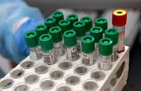 Gesundheitsminister mückstein warnt vor „trügerischer situation. Corona Infektionen In Osterreich Gehen Weiter Zuruck Wiener Zeitung Online