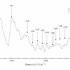 Figures for 2017 and 2018 are. Pdf Diverse Region Based Cnn For Tongue Squamous Cell Carcinoma Classification With Raman Spectroscopy