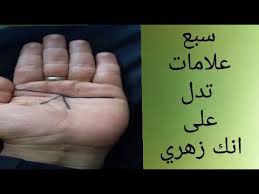 الزهريين اسرار هامة عن الزهريين لاول مره وتعريف الزهريين الجزء الاول نتناول في الحلقه شرح اسرار اسرار الانسان الزهري. Ø³Ø¨Ø¹ Ø¹Ù„Ø§Ù…Ø© ØªØ¯Ù„ Ø¹Ù„Ù‰ Ø§Ù†Ùƒ Ø²Ù‡Ø±ÙŠ ÙŠØ¬Ø¨ Ø¹Ù„ÙŠÙƒ Ø§Ù„Ø­Ø¯Ø± Ù…Ù† 666 Youtube