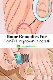 Pin On Home Remedies