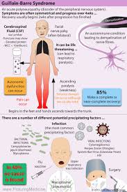 It can lead to weakness and paralysis that may last for months or years. Guillain Barre Syndrome An Acute Polyneuropathy Disorder Grepmed