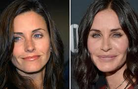Dec 13, 2019 · celebrity botox: Top 25 Celebrities Before And After Plastic Surgery And Nose Jobs