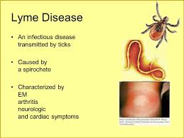 Lyme Disease In Los Angeles Ppt Video Online Download