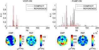 From 'borat' to 'bridesmaids', we count down the best comedy movies and funniest films of all time as chosen by time out writers and top comedians. Length Matters Improved High Field Eeg Fmri Recordings Using Shorter Eeg Cables Sciencedirect