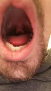 When functioning properly, it swings upward to block food from entering your nose when you. Since We Re Doing Weird Oral Features Have A Look At My Bifurcated Uvula Wtf