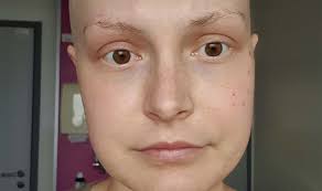 Ovarian cancer: Symptoms may include bloating and difficulty eating