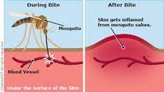 We did not find results for: Why Do Mosquito Bites Itch Siowfa15 Science In Our World Certainty And Controversy