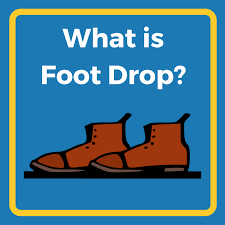 Image result for Foot Drop