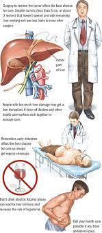 Signs and symptoms of liver cancer some early cancers may have signs and symptoms that can be noticed, but that is not always. Liver Cancer Upper Gi Cancers Spectrum Health