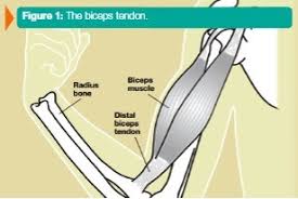 Tendons are fibrous cords, similar to a rope, and are made of collagen. Distal Biceps Tendon Problems Manhattan New York