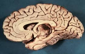 Sagittal and axial sections of the brain + Sagittal Cross Section Of Brain Diagram Quizlet