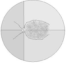 Diagram Of Fundus Wiring Diagram General Helper