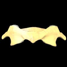 It is named for atlas of greek mythology because, just as atlas supported the globe, it supports the entire head. File Atlas The First Cervical Vertebra Gif Wikipedia