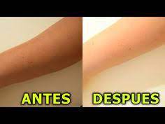 Blanquea La Piel En Casa En 1 Minuto Aclara La Piel Quemada Por El Sol Aangie Youtube Piel Quemada Como Aclarar La Piel Blanquear La Piel