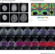 In addition, the child's level of motivation may also affect test results. Imaging Structural And Functional Brain Development In Early Childhood Nature Reviews Neuroscience