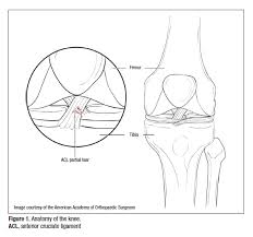 Pain Management After Acl Surgery