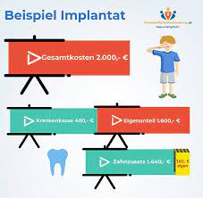 Dass eine versicherung nicht zahlt, kann verschiedene gründe haben. Zahnzusatzversicherung Gunstig Bei Privatehaftpflichtversicherung De